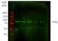 TM2 | Tobacco mosaic virus resistance-2 in the group Antibodies Plant/Algal / Plant Pathogens / Viruses at Agrisera AB (Antibodies for research) (AS15 3062)